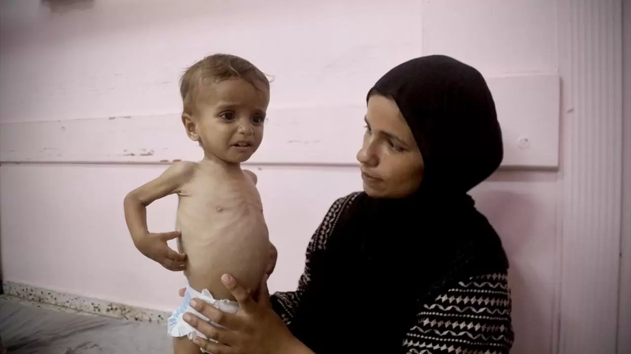 Gazze'de sessiz çığlık! Hastanelerdeki çocuklar adeta ölümü bekliyor 10