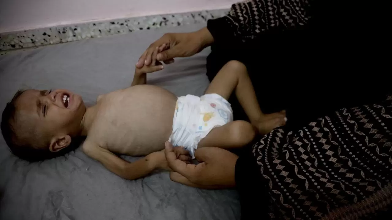 Gazze'de sessiz çığlık! Hastanelerdeki çocuklar adeta ölümü bekliyor 7