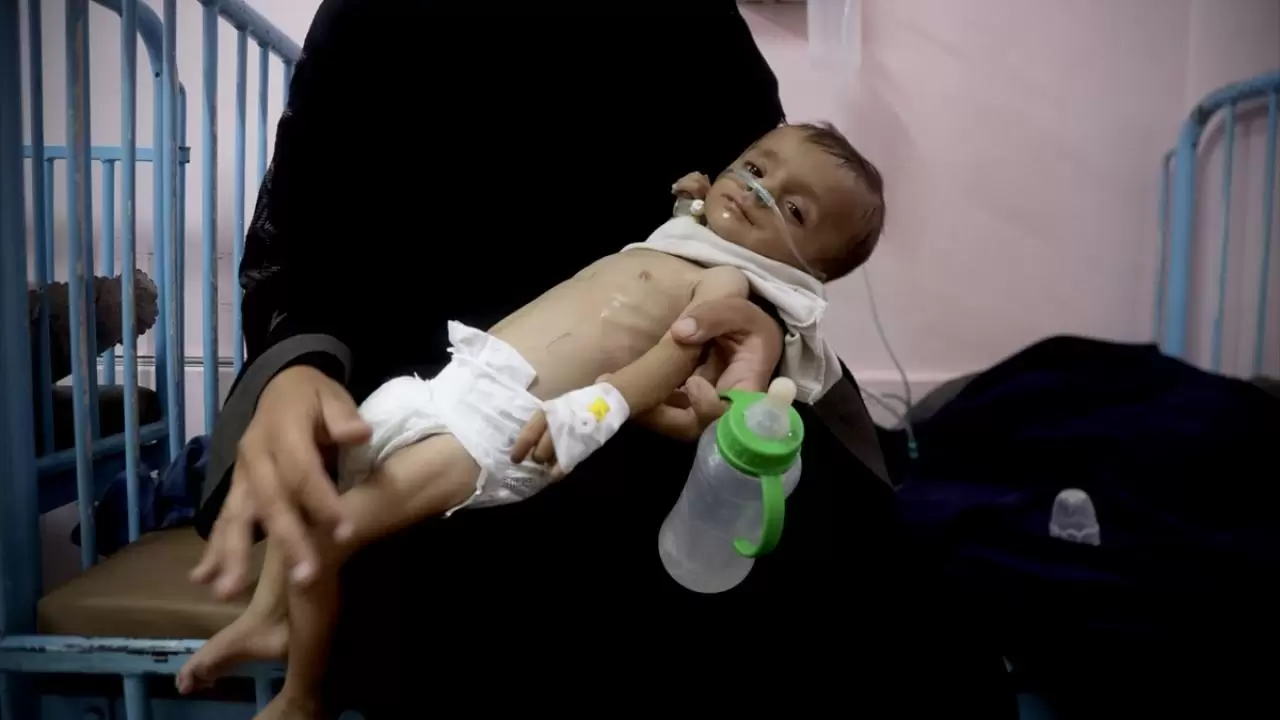 Gazze'de sessiz çığlık! Hastanelerdeki çocuklar adeta ölümü bekliyor 3