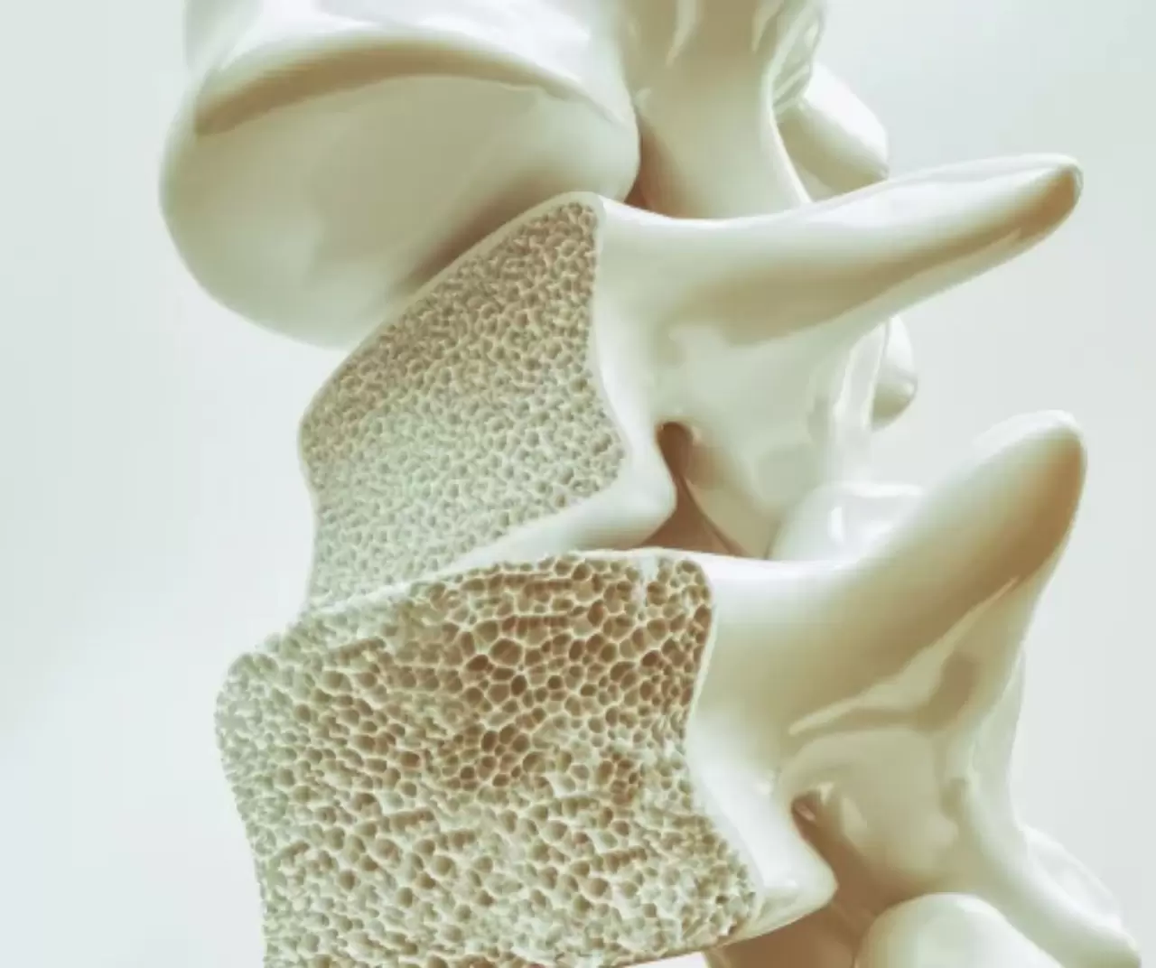 20 Ekim Dünya Osteoporoz Günü’nde kemik sağlığına dikkat çekildi 2