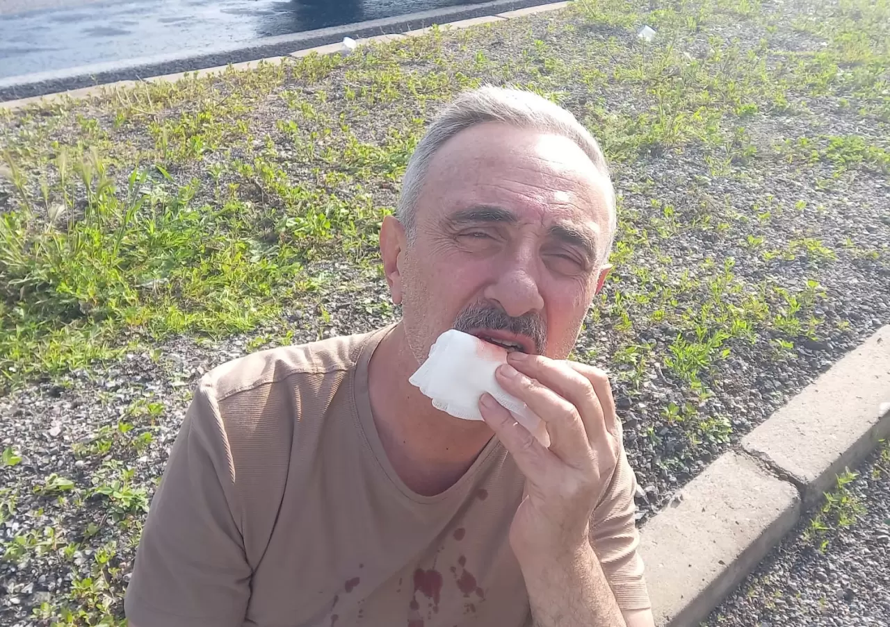 Aksaray-Nevşehir yolunda tur otobüsü kaza yaptı 7