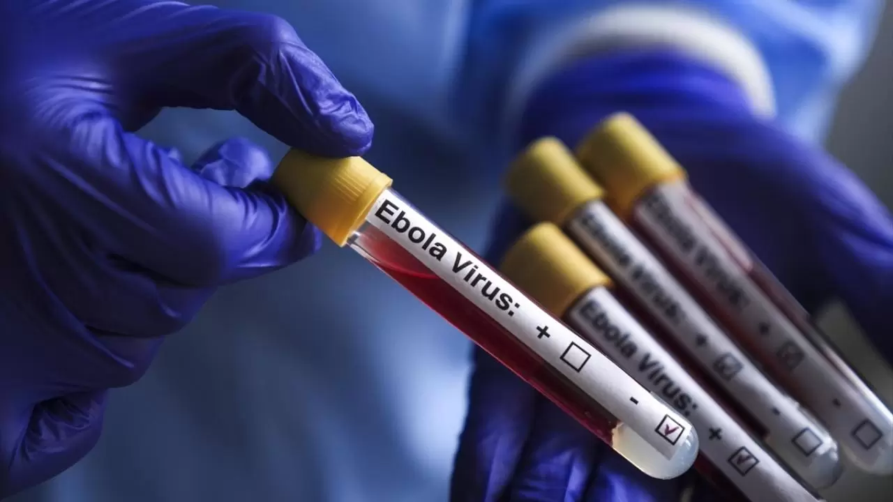 İsrail’de ilk kez Ebola alarmı! Aşısı ve tedavisi olmayan varyant kapıda! 8