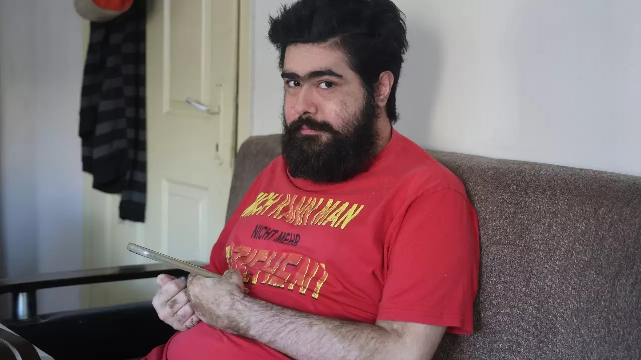 Barış Özbay 3 aylık tedavinin ardından evine döndü 3