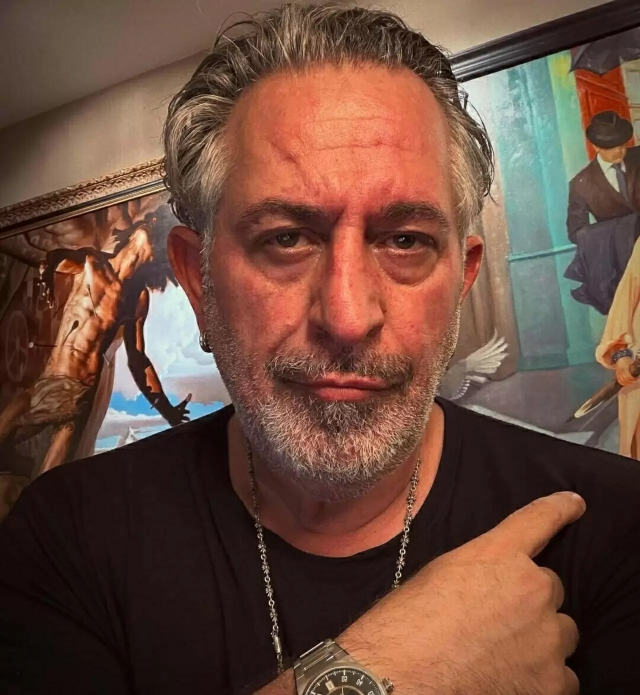 Cem Yılmaz'ı ölümden döndüren doktorlardan açıklama 4