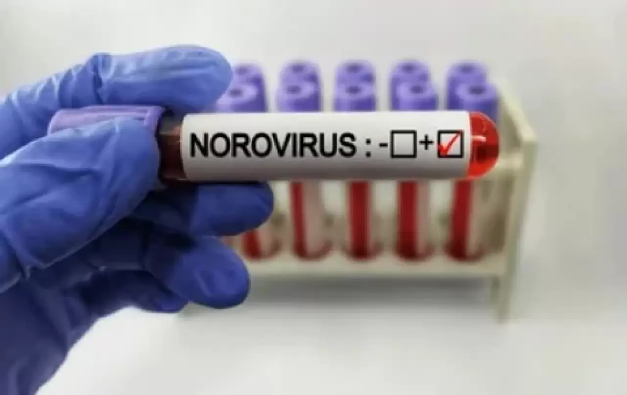 Norovirüs